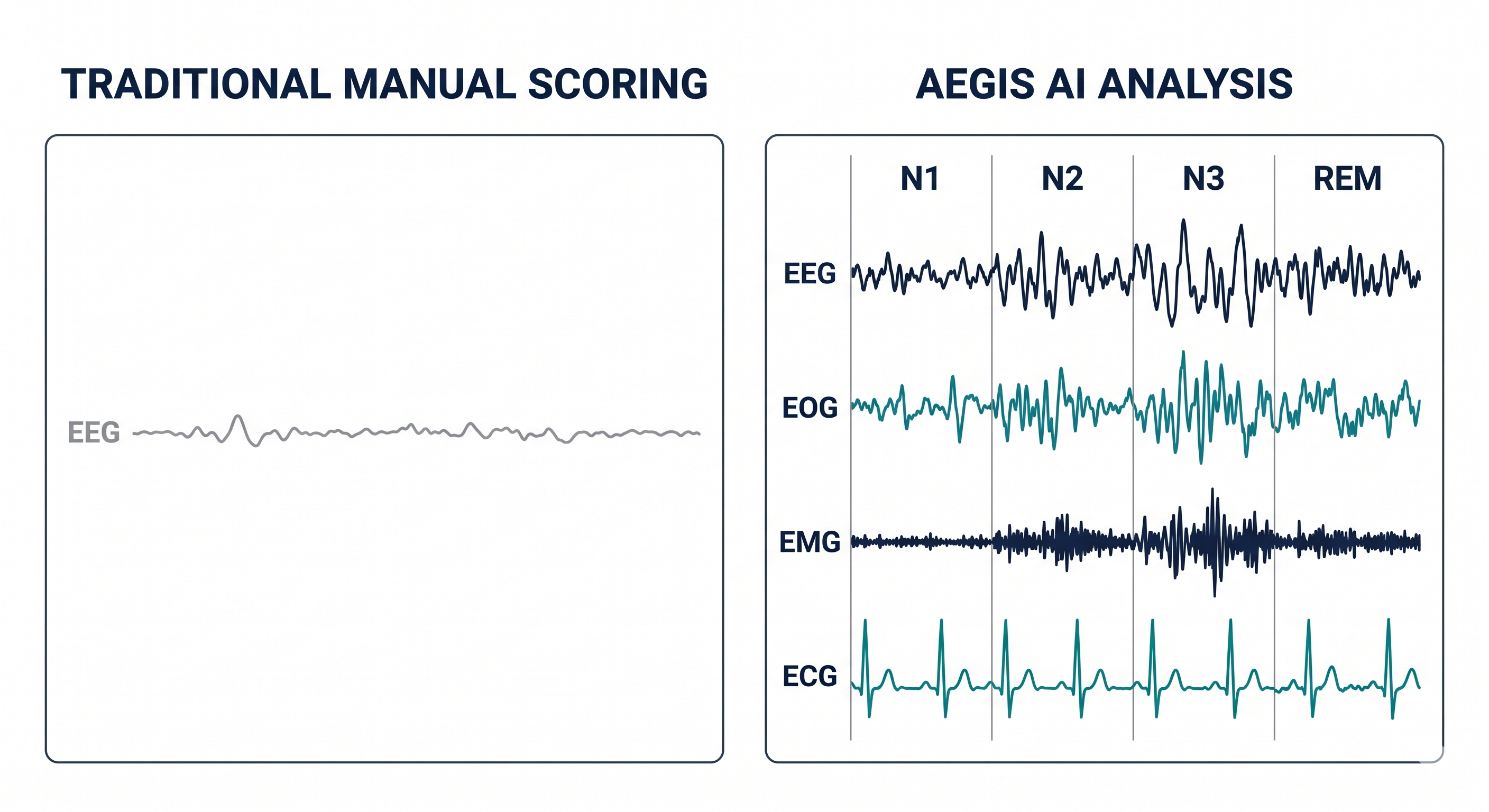 AI vs Manual Sleep Scoring Comparison